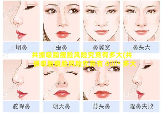 共振吸脂瘦脸风险究竟有多大(共振吸脂瘦脸风险究竟有 🌺 多大了)